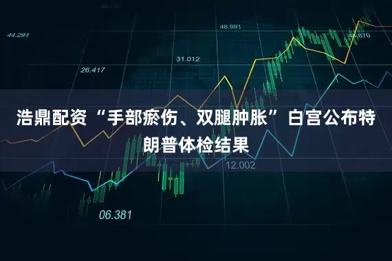 浩鼎配资 “手部瘀伤、双腿肿胀” 白宫公布特朗普体检结果